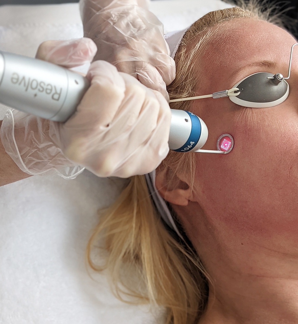 picoway resolve 1064 young-woman-professional-eyebrow-mapping-procedure-before-permanent